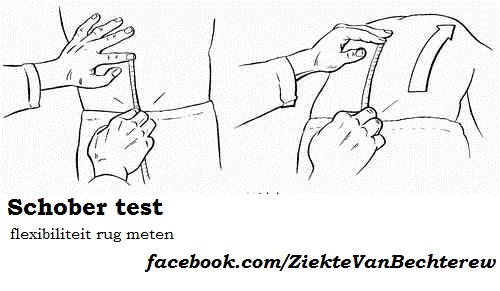 Schober test