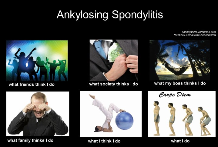 Spondylitis - what society thinks I do