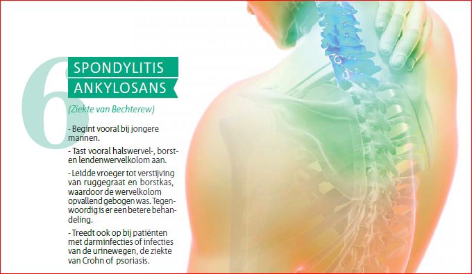Spondylitis
