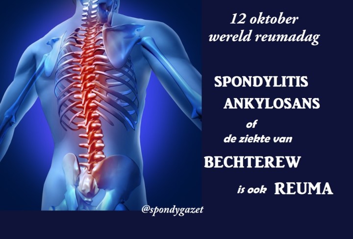 De ziekte van Bechterew is ook reuma